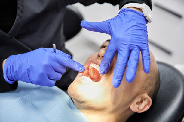 Best Chipped Tooth Repair Near Me  in Lanster, CA